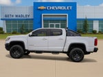 2018 Chevrolet Colorado ZR2